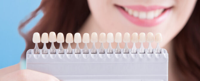 Porcelain Veneers: Your Journey to a Dazzling Smile