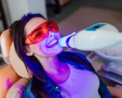 Professional vs. DIY: The Truth About Teeth Whitening