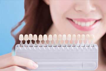 scottsdale az same day veneer