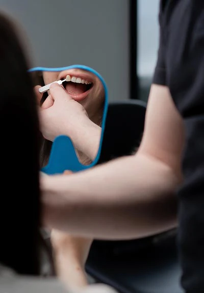 dental veneers Scottsdale, AZ