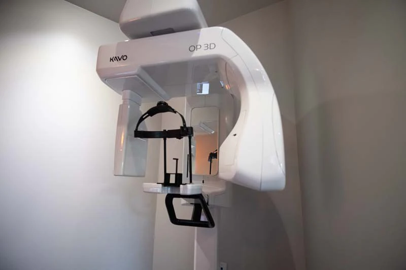 3D digital X-rays used at Serenity Smiles
