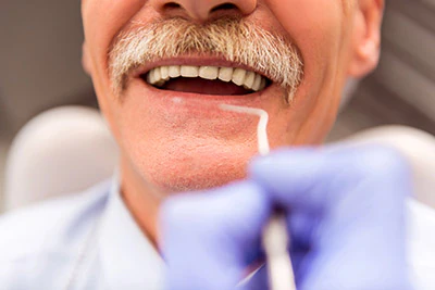 man visiting Serenity Smiles for same-day dental care