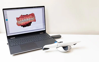 intraoral camera used at Serenity Smiles